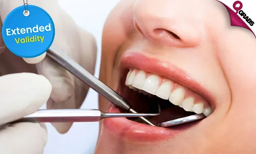 Killer Dental Package: Scaling & Polishing + Consultation!